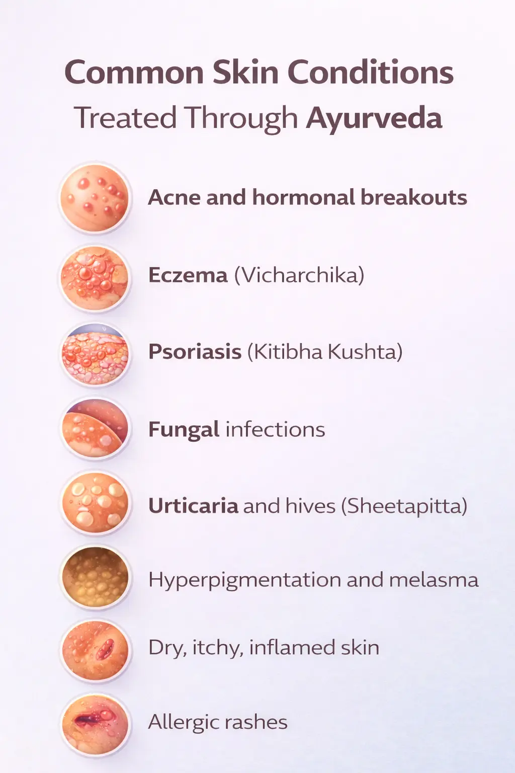 ChatGPT Image Dec 16 2025 at 05 27 10 PM | Vishuddhi Isha Yoga Goa India Infographic showing common skin conditions treated through Ayurveda including acne, eczema, psoriasis, fungal infections, urticaria, hyperpigmentation, allergic rashes, and itchy inflamed skin